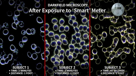 The smart meters emit high levels of pulse radiation that is proven to be damaging to blood cells of all living beings.