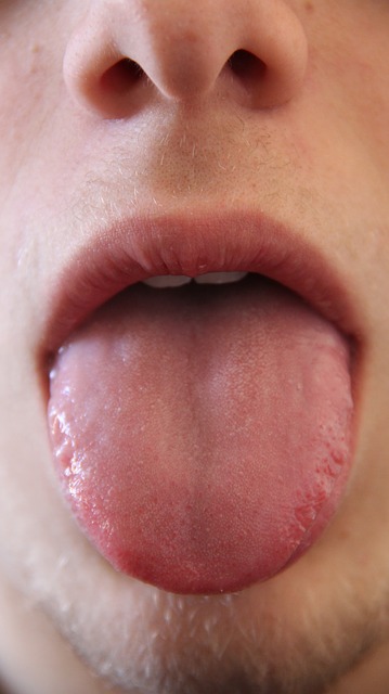 Our tongue shows our health