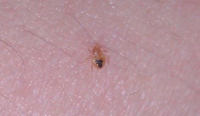 the dark portion of the body tells us that this baby bed bug has started a sizes b83 bug