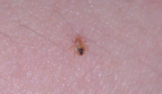 Bed bugs, toddlers and a newborn. - BabyCenter