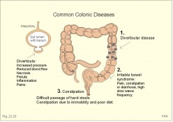 Discovery: Fasting Stops Peristalsis Giving Colon a Rest