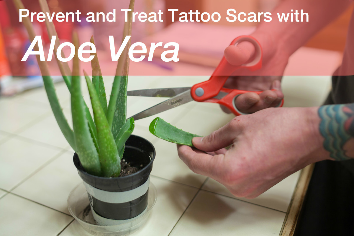 How can you prevent welts from turning into scars?