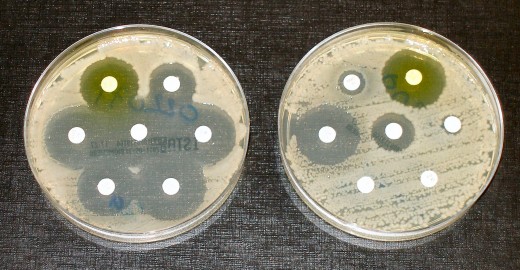 Antibiotic resistance tests: Bacteria are added in streaks on the dish with antibiotics on the white disks. Bacteria in the culture on the left are susceptible to the antibiotic in each disk.Those on the right are fully susceptible to only three