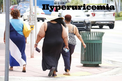 Fat women walking in the street.