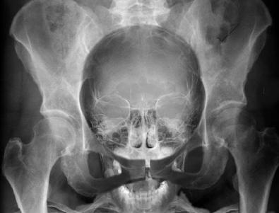 Could this really be an X-ray of the approximate anatomical location of our dear writer's head?