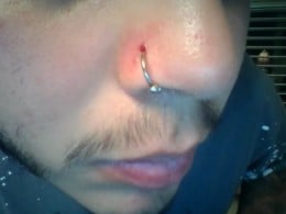 So my nose hoop wont stop scabbing and bleeding when I ...