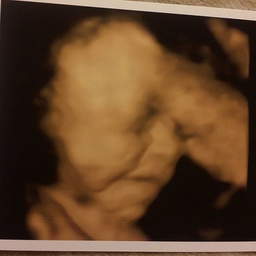Laralei Michelle 3D/4D ultrasound 30 weeks. 