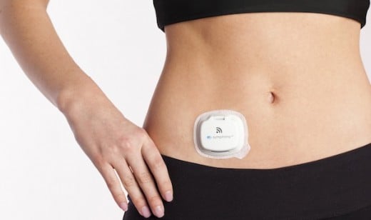 Continous Glucose Monitor, also known as CGM