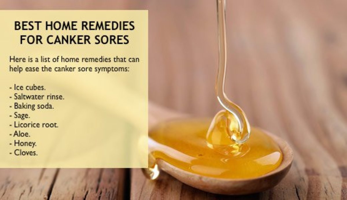 10 Home Remedies for Healing Canker Sores (Naturally)