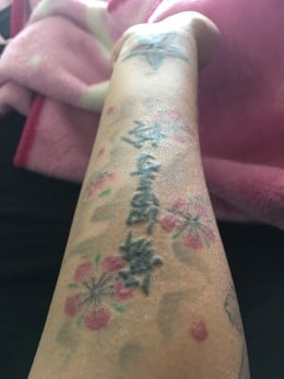 Fellow tattooed friends: Do your tattoos itch or become raised at times? Fellow tattooed friends: Do your tattoos itch or become raised at times?