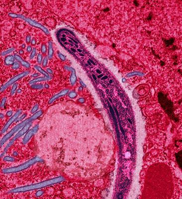 A Plasmodium from the saliva of a female mosquito moving across a mosquito cell