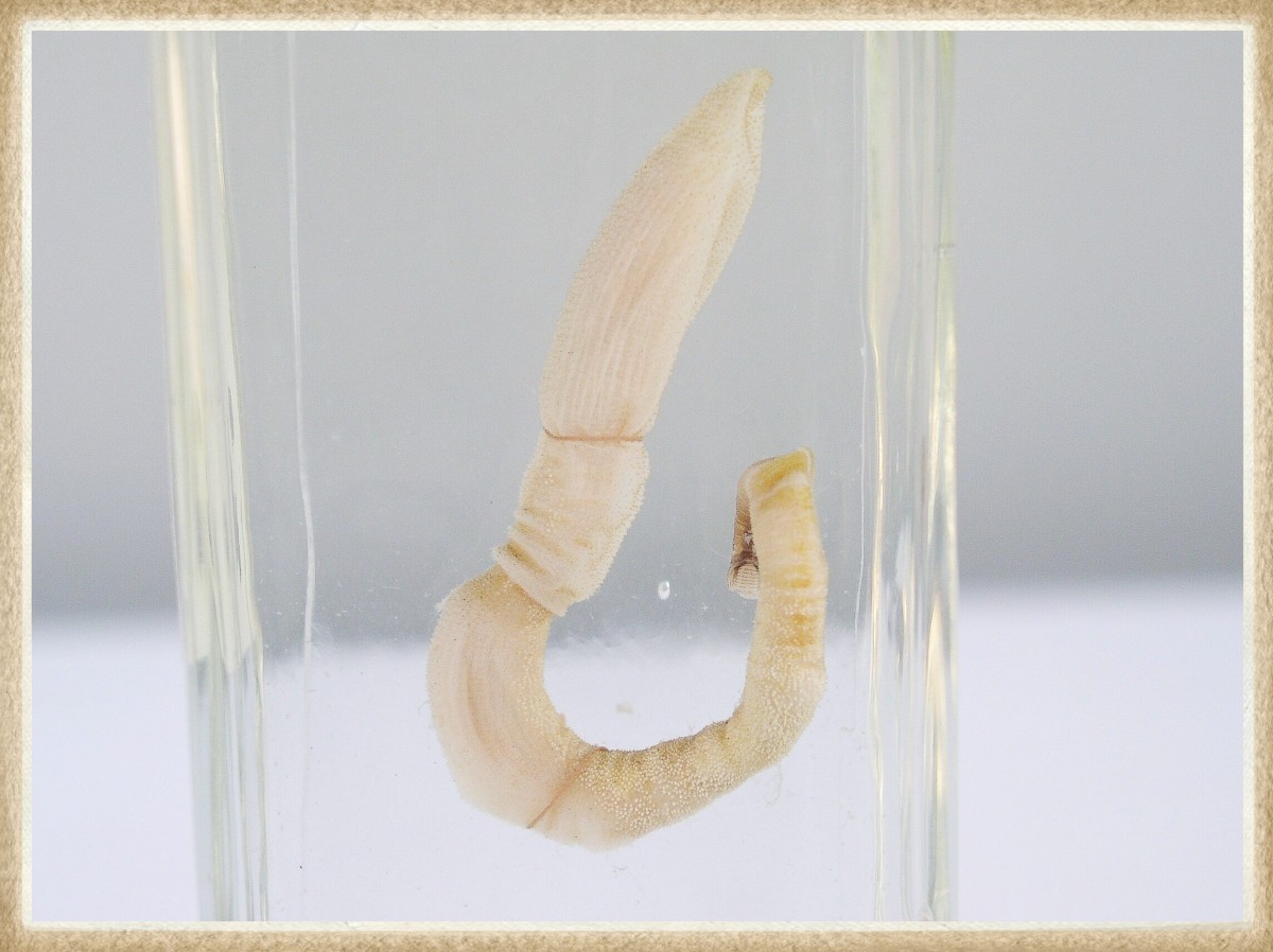 Acorn Worms and Regeneration of Human Body Parts