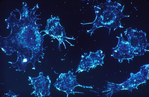 Cancer cells are cells trying to grow where they don't belong.  Stem cells are cells that try to become the cells they are replacing.  