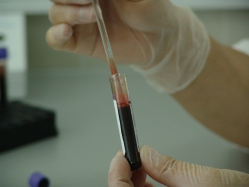 Can you handle the sight of blood? Phlebotomist may be the career choice for you!