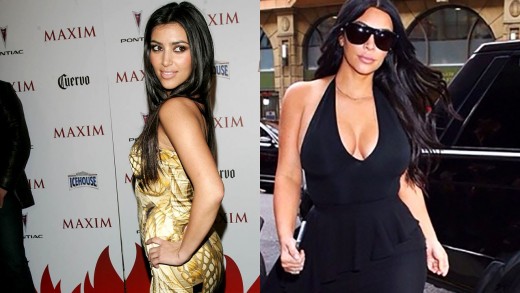 Kim Kardashian before and after a wide variety of surgeries.