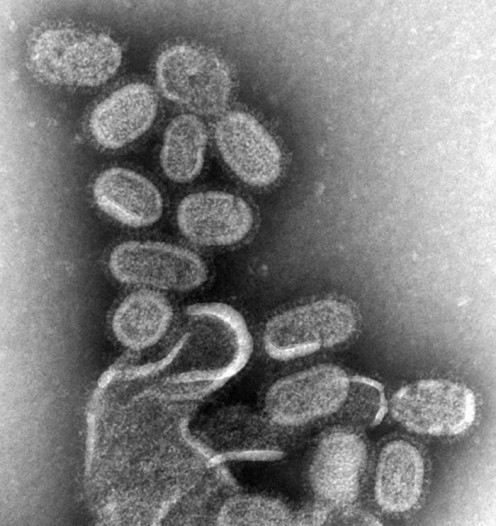 The Influenza Virus