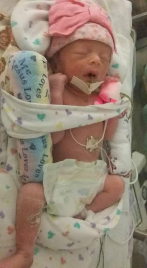 After birth then surgery within minutes. ON pain medicine and oxygen to help her sleep