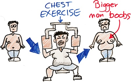 What causes Man Boobs