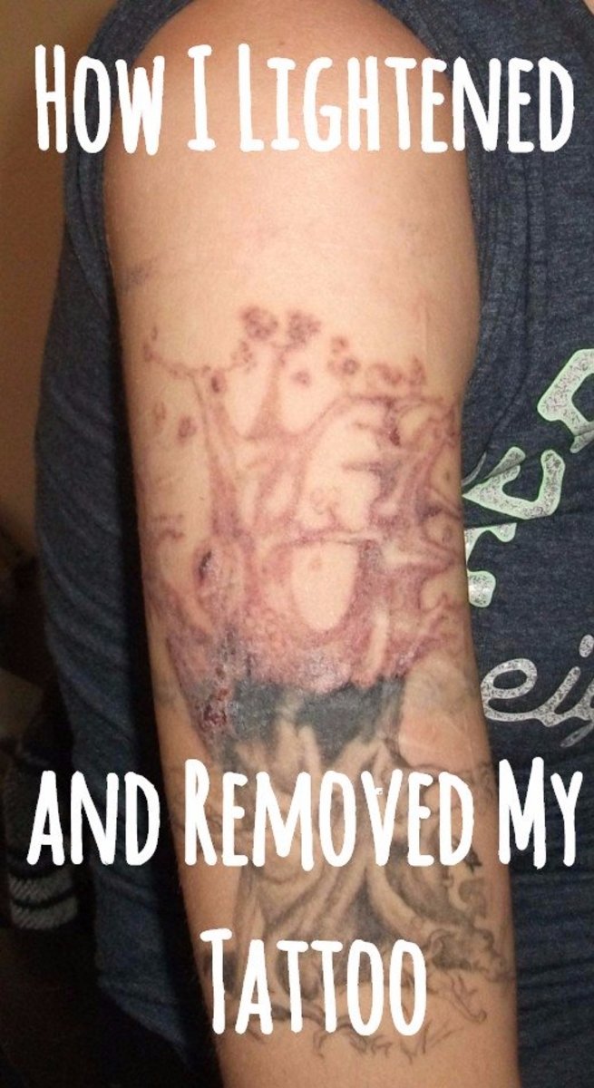 My Experience Lightening and Removing My Tattoo at Home ...