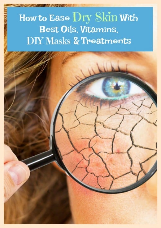 How To Deal With Dry Skin On The Face With Best Solutions And ...