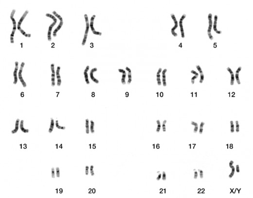 The human genome consist of 23 pairs of chromosomes, each made of long strands of DNA. It is estimated that around 1% of it came from other species.