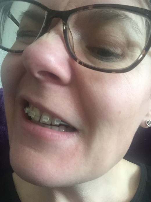 Not flattering at all!