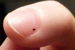 Finding Tiny Ticks on Furry Dogs Made Easy
