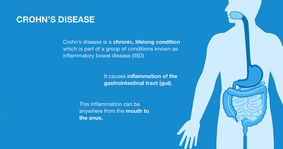 So, what is Crohn's disease