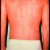 Erythrodermic Psorisis Erythrodermic Psorisis