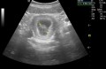 First Trimester Woes Week 1-13