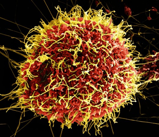 Ebola Virus Particles  Colorized scanning electron micrograph of filamentous Ebola virus particles (yellow) attached to and budding from a chronically infected VERO E6 cell (red) (25,000x magnification).