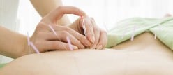 Commonly Asked Acupuncture Questions
