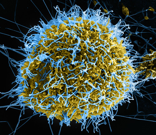 An electron microscope reveals blue Ebola virus particles colonizing a cell.