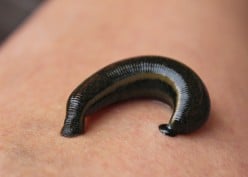 Leeches, What Are They Good For?