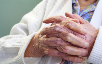 Elderly people often develop age spots on their hands.