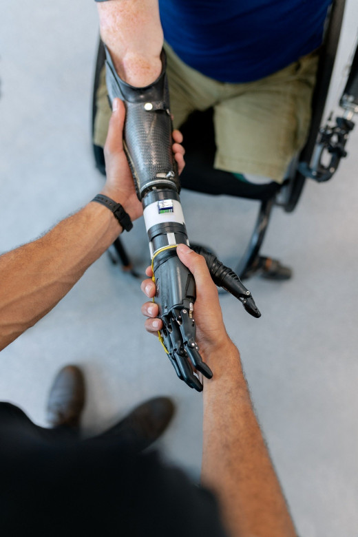 A robotic prosthetic arm.  