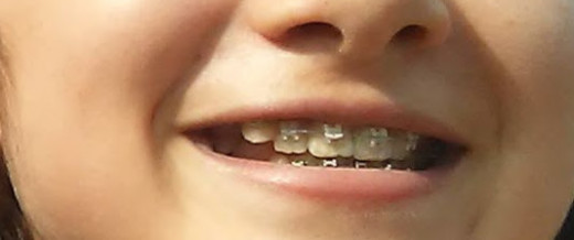 healthy mouth