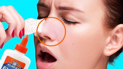 Busted and Bashed! a Big No-No to These Beauty Hacks and Myths