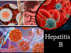 Is Hepatitis B Curable?