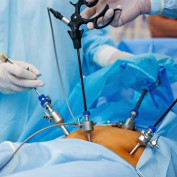 bilal50 profile image