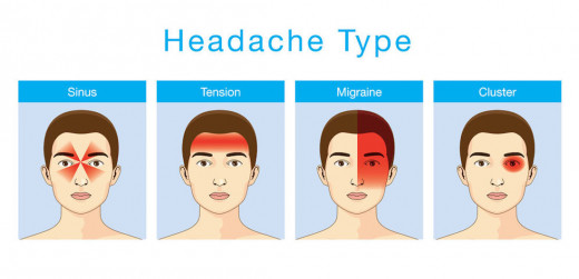 Understanding Different Types of Headaches and Their Causes