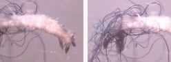 Morgellons Disease - New, Strange, and Scary - Health and Disease