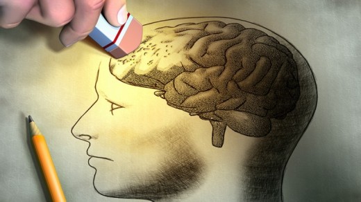 Brain damage can be a result of inbreeding.
