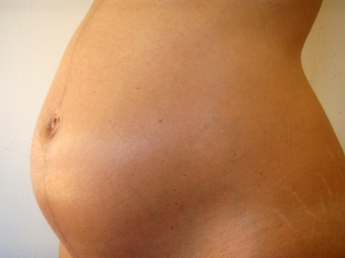 Pregnant