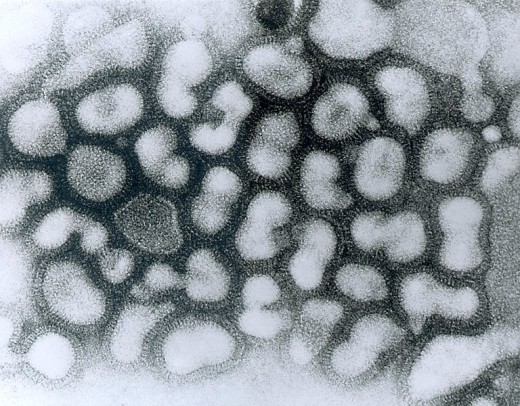 Photo-micrograph of Influenza A