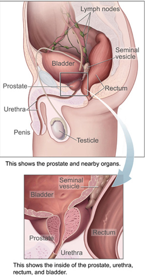 Fig. 3: Diagram of male pelvic area, including prostate (National Cancer Institute, 2008).