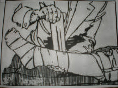 2. The bandage should be as tight as you would apply to a sprained ankle. 