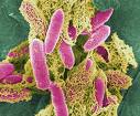 E coli        photo rosemerina.com