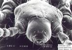 Another monster, the blood louse as it appears to another louse          photo gettysburg.edu.com.            