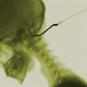 selfinflicted profile image